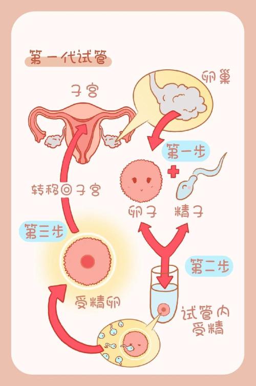 供卵试管过程_供卵试管：孕育生命的奇迹